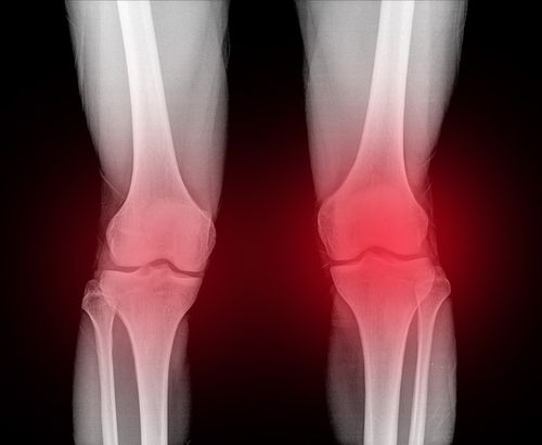 Rueb Stoller Daniel Los Angeles, CA Office